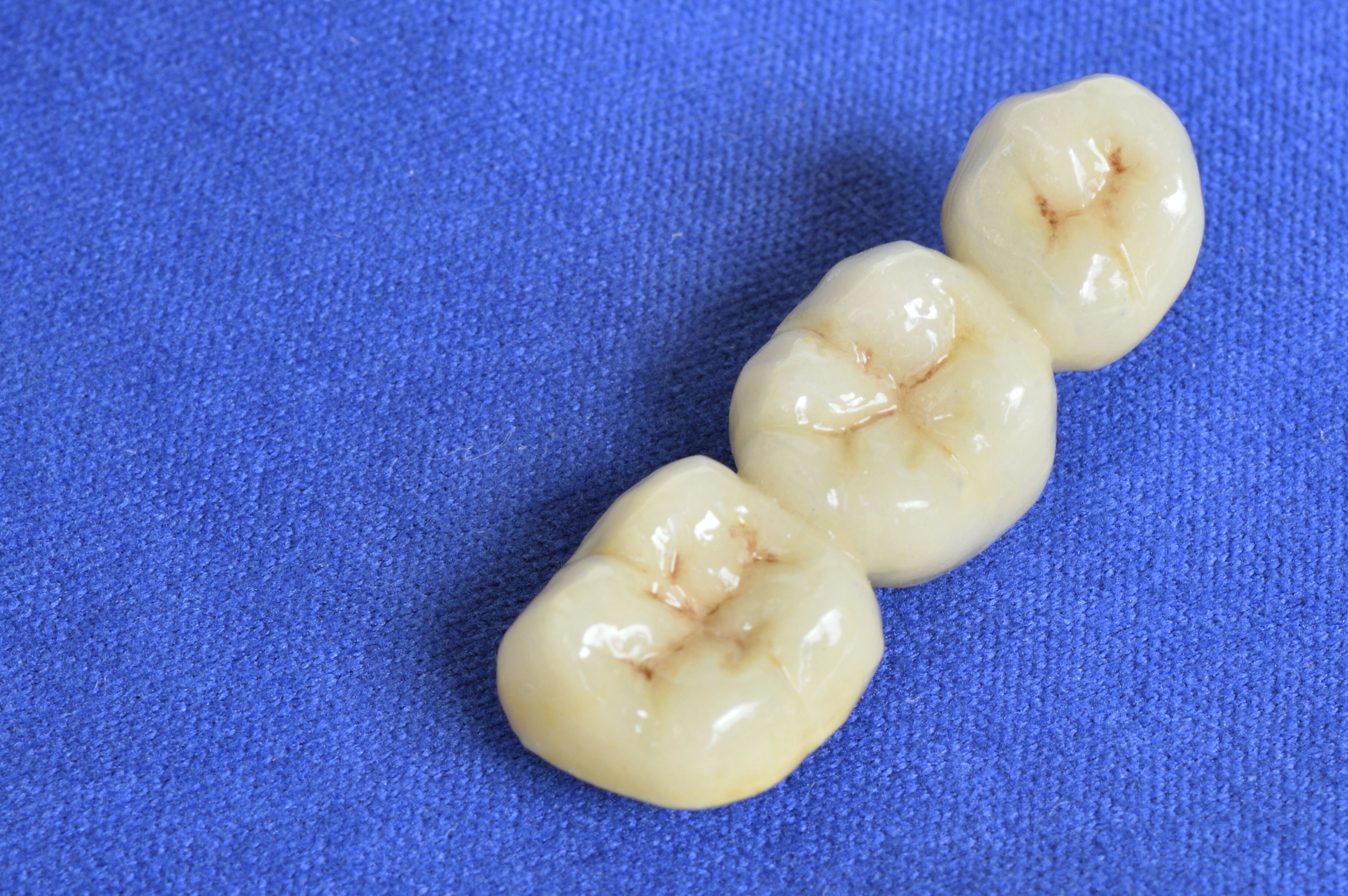 セラミックブリッジ